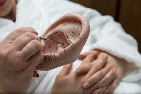 Auricular acupuncture at Weavers House Spa at The Swan at Lavenham Hotel image Matt Finch med 1996